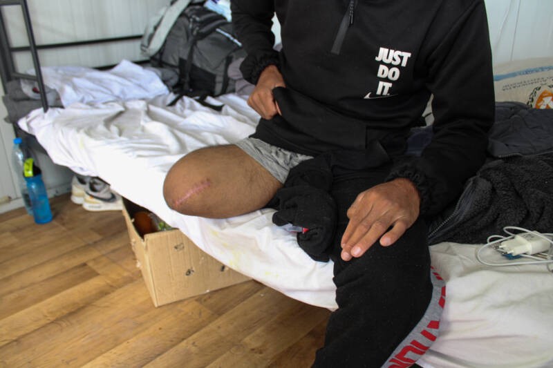 Muhammad Daoud made the crossing from Syria to Cyprus with a friend (pictured). Both were injured by a police boat collision, and his friend’s leg was later amputated, 27/03/2024 (Hanna Davis/Syria Direct)